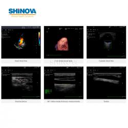 Trolley Veterinary Color Doppler