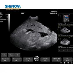 Touch Color Doppler Ultrasound Scanner System