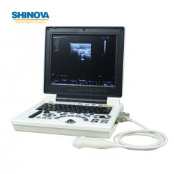 Full Digital Ultrasound with PW